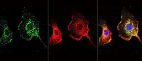 Neurodegeneration, research images